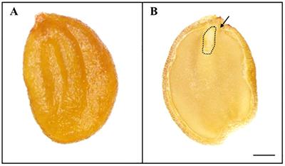 Improving seed germination: effect of stratification and dormancy-release priming in Lonicera insularis Nakai